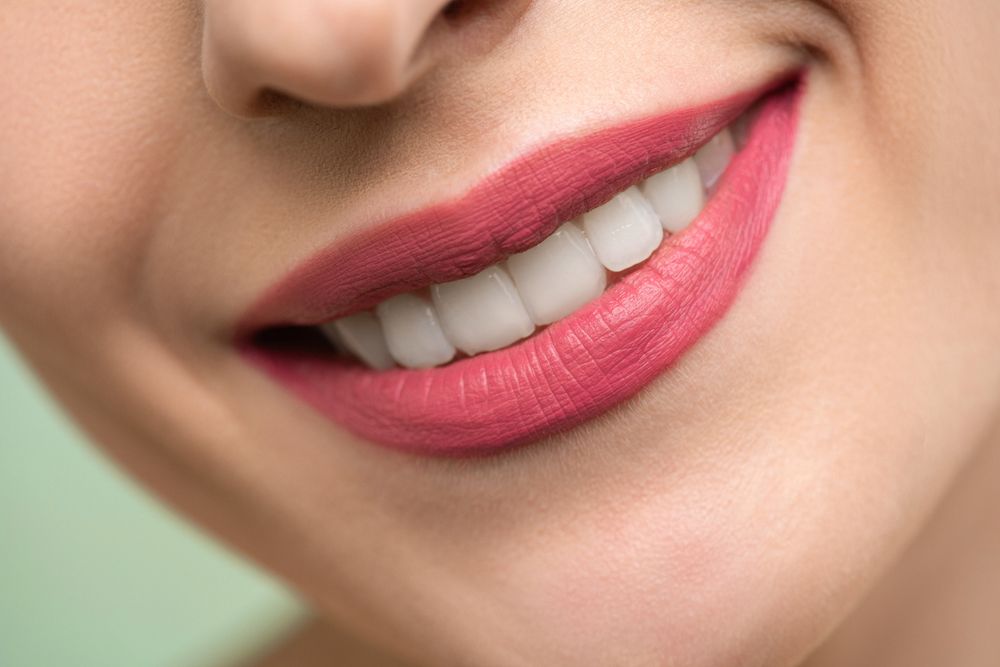 Teeth whitening